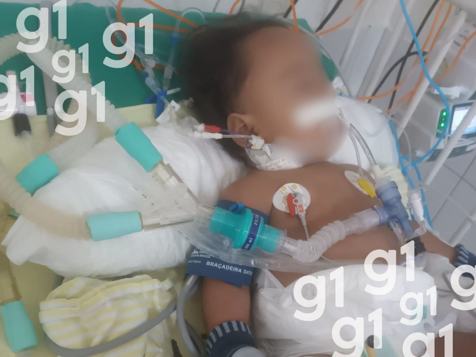 Criança internada em hospital em Rio Branco é acompanhada pela mãe.